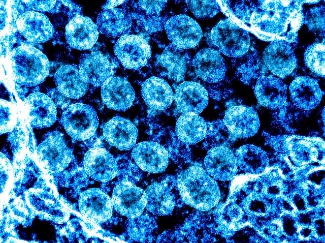 Coronavirus, netto calo dei contagi in Abruzzo, 18 nuovi casi positivi 
